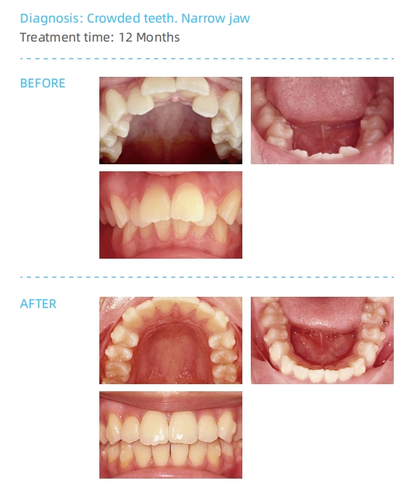 4ad03f72-1b65-6004-73b3-b7eace6ca6f4.png 4ad03f72-1b65-6004-73b3-b7eace6ca6f4.png