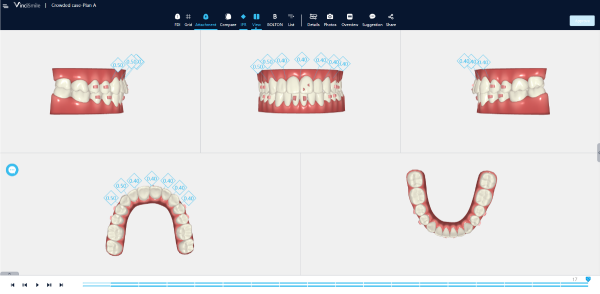 90b10ae6-da9c-f7fb-d488-34a9c1eda893_副本.png 90b10ae6-da9c-f7fb-d488-34a9c1eda893_副本.png