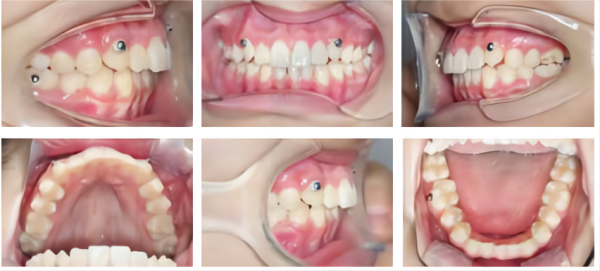 06d77518-f96b-a59f-f2b7-c73ad817aa29_副本.png 06d77518-f96b-a59f-f2b7-c73ad817aa29_副本.png