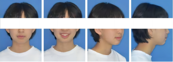 313fcef3-9380-e0a2-b391-5229d9cbb922_副本_副本1.png 313fcef3-9380-e0a2-b391-5229d9cbb922_副本_副本1.png