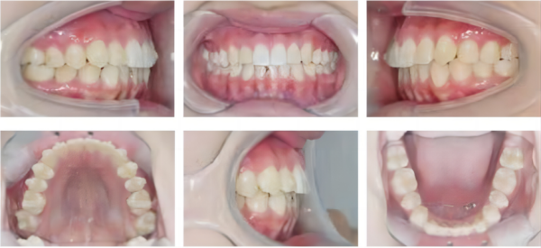 313fcef3-9380-e0a2-b391-5229d9cbb922_副本_副本2.png 313fcef3-9380-e0a2-b391-5229d9cbb922_副本_副本2.png