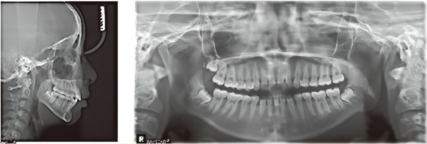 313fcef3-9380-e0a2-b391-5229d9cbb922_副本_副本3.png 313fcef3-9380-e0a2-b391-5229d9cbb922_副本_副本3.png