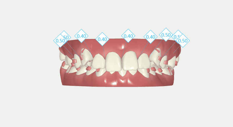 8c91c84f-55c7-ca48-578a-22f65d3e2783.gif 8c91c84f-55c7-ca48-578a-22f65d3e2783.gif