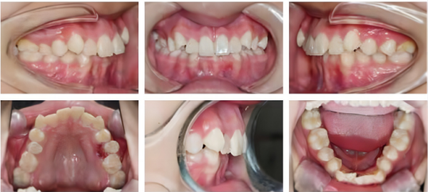 af4d3b9c-a84d-2f94-7d79-ae704756901d_副本_副本2.png af4d3b9c-a84d-2f94-7d79-ae704756901d_副本_副本2.png