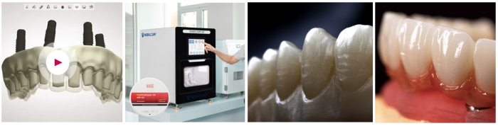 Discover the Future of Dental Excellence with HUGE Digitalife<ALIMT >&trade;</ALIMT> 9