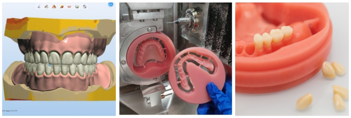 Discover the Future of Dental Excellence with HUGE Digitalife<ALIMT >&trade;</ALIMT> 5