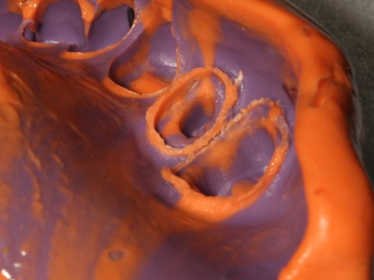 CLINICAL CASES:PERFIT IMPRESSION MATERIALS 3 CLINICAL CASES:PERFIT IMPRESSION MATERIALS 3