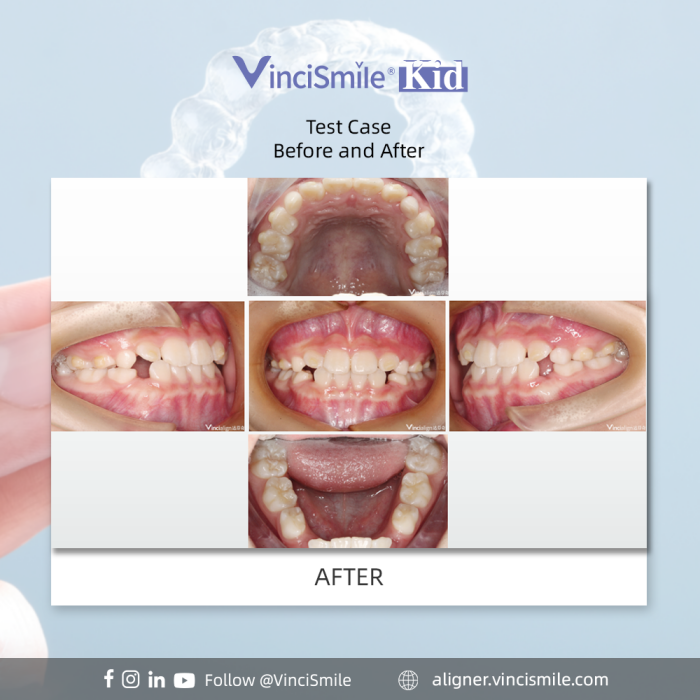 275d056f-dd6d-c18d-48cb-2e75c70c782d_副本.png 275d056f-dd6d-c18d-48cb-2e75c70c782d_副本.png