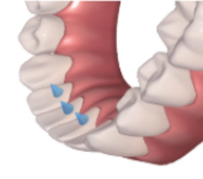 3199dbc4-d50a-53b8-0e9d-91783c70c39b_副本.png 3199dbc4-d50a-53b8-0e9d-91783c70c39b_副本.png