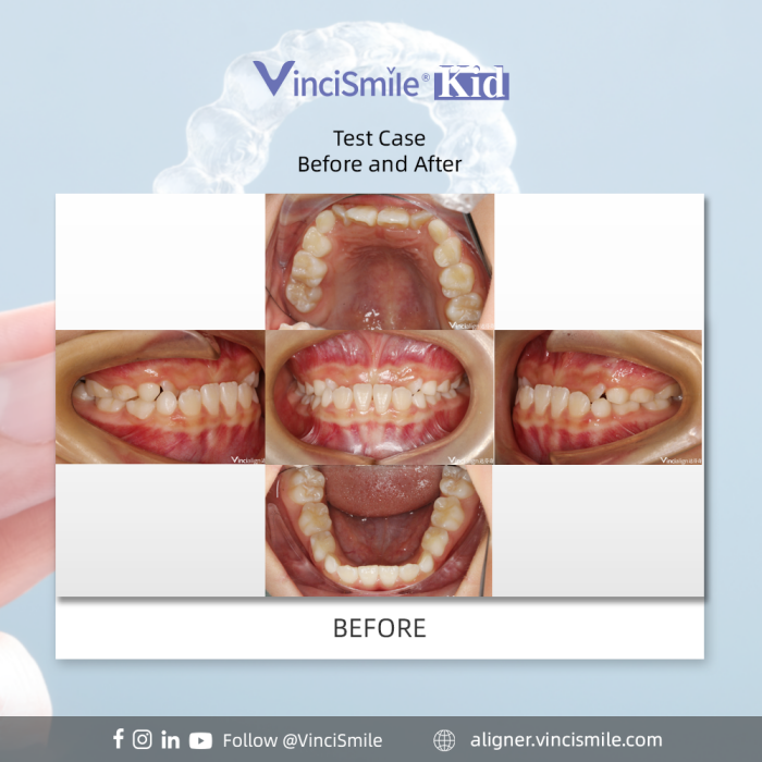 b189e3a9-4cc3-c4d4-958f-0ce2e1194677_副本.png b189e3a9-4cc3-c4d4-958f-0ce2e1194677_副本.png