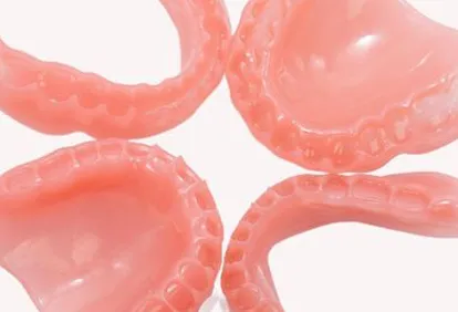 義歯床の3Dプリント