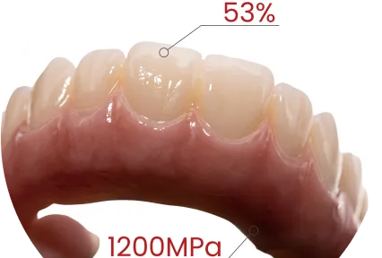 フルアーチ対応。審美性も完備。実際の臨床例で見るMM-4Dジルコニア